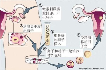 林主任